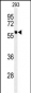PPM1G Antibody (Center)